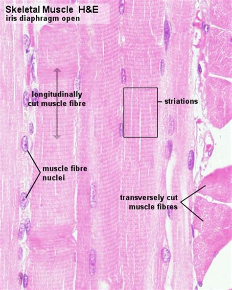 17 Best images about Histology - Muscle on Pinterest | Muscle tissue