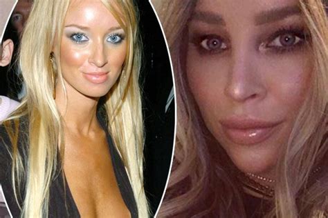 Lauren Pope Before Surgery The Only Way Is Essex Star Without Nose Job