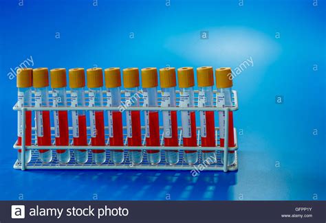 Vacutainer Test Tubes Hi Res Stock Photography And Images Alamy