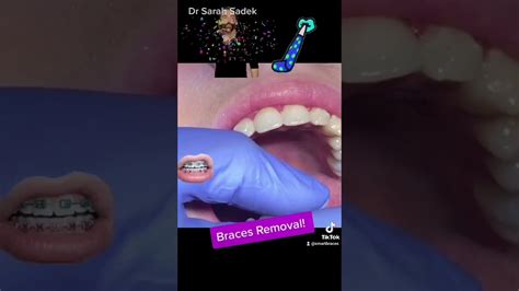 braces removal shorts youtube