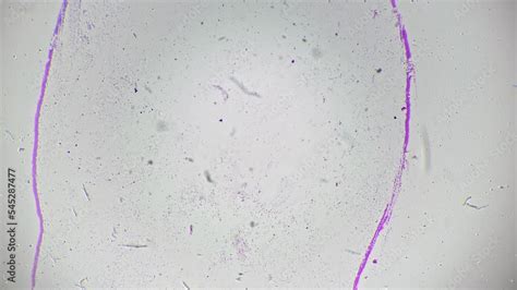 Escherichia Coli Smear Under Microscope 40x Scientific Slide On Bright