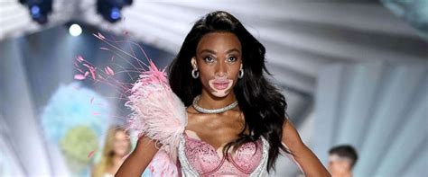 Winnie Harlow Breaks Barriers As The First Model With