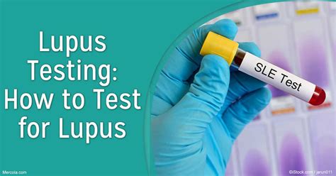 Users can compare their dna to everyone else in the database or to a specific individual in the database go to knowyourgenetics.com and enter your dna test results for a free personalized supplementation report. Lupus Testing: How to Test For Lupus