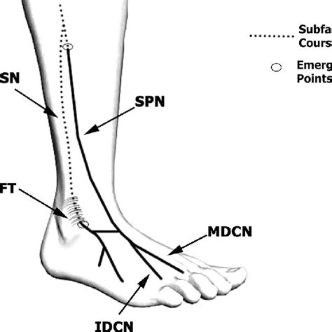 Schematic Demonstration Of The Accessory Superficial Peroneal Sensory
