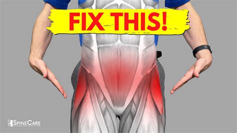 How To Fix Pelvic Pain For Good Youtube