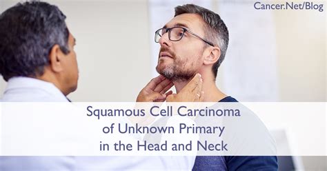 Squamous Cell Carcinoma Of Unknown Primary In The Head And Neck An