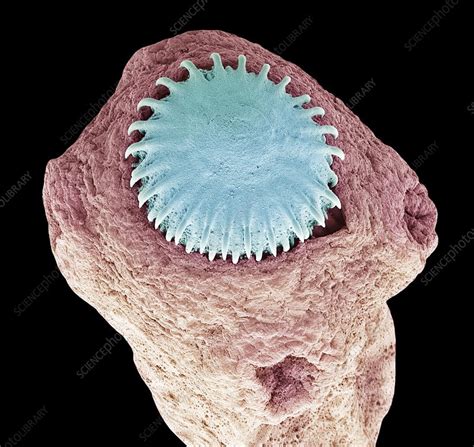 Tapeworm Sem Stock Image C0169080 Science Photo Library