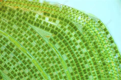 Mougeotia And Spirogyra Filamentous Algae Light Micrograph Stock