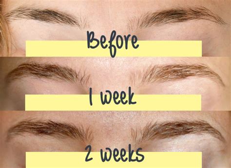 Brow Growth Serum Brow Growth Serum Brow Growth How To Grow Eyebrows