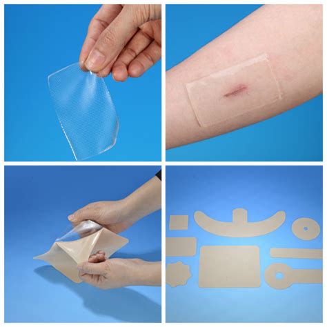 Silicone Gel Sheet For Curing The Scar China Hypertrophic Scars And