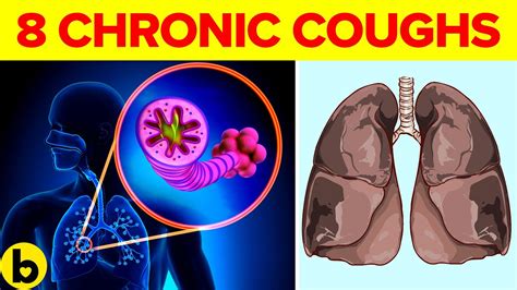 8 causes of chronic cough and what you can do about it youtube
