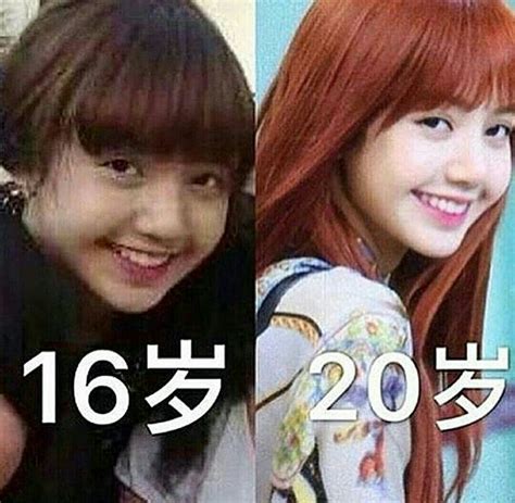 Blackpink continues to top major music charts domestically and abroad. Blackpink Lisa Nose Plastic Surgery