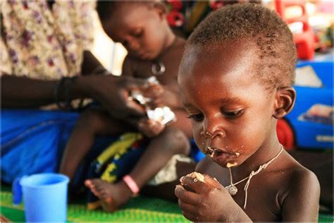 Lutte Contre Le Kwashiorkor Quand La Communauté Devient Un Atout Dans