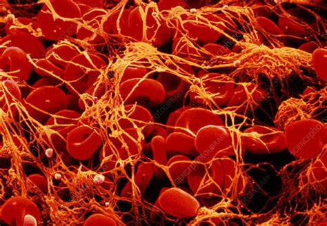 Blood Clot Stock Image P2600064 Science Photo Library