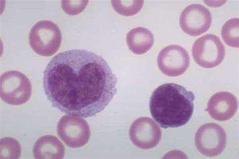 Normal White Blood Cells On A Smear Medical Laboratories