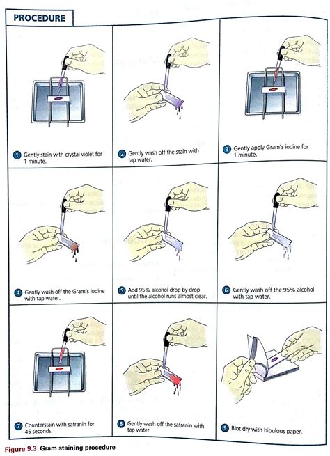 Gram Staining Procedure Microbiology Medical Laboratory Technician
