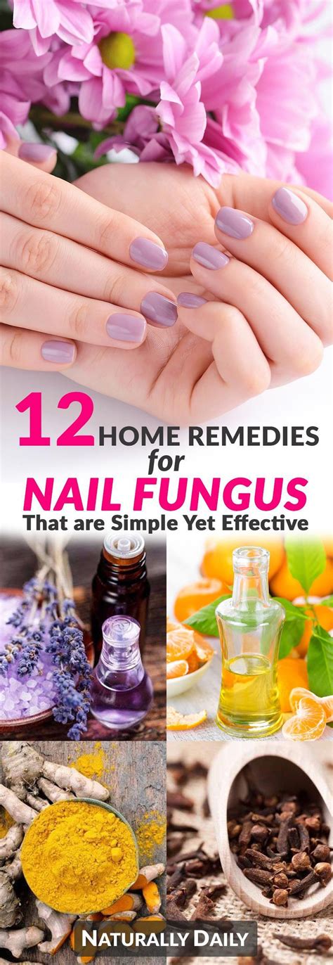 12 Home Remedies For Nail Fungus That Are Simple Yet Effective