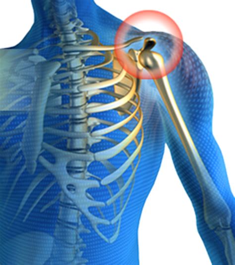 Shoulder Joint Pain Causes Treatment And Exercises For Natural Pain