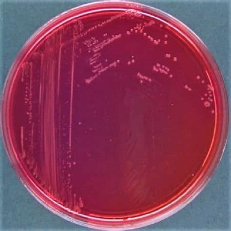 Salmonella On Xld Agar Plate Pics For Xld Agar Microbiology Medical