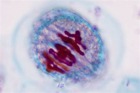 Metaphase Under Microscope Labeled Micropedia