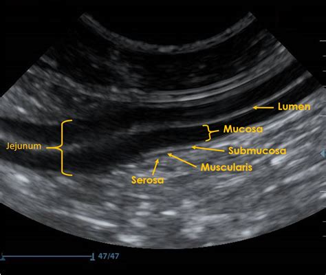 Ultrasonography Gastrointestinal Tract Imv Imaging