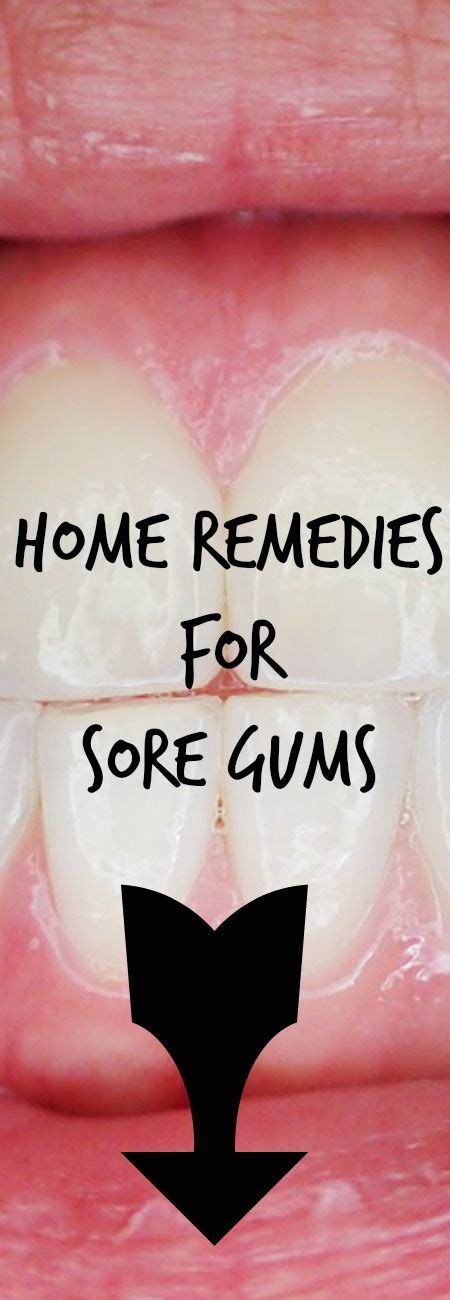 Home Remedies For Sore Gums See Your Dentist And Try These Home