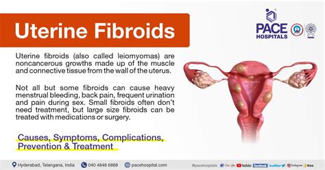 Uterine Fibroids Types Symptoms Treatments Infographi