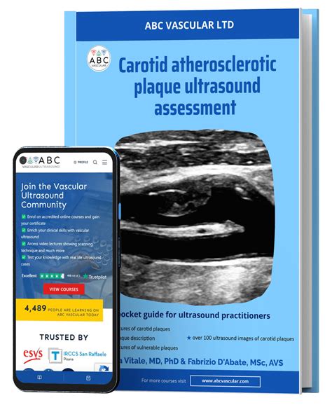 Vascular Ultrasound Book - ABC Vascular