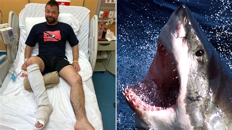 Warning Graphic Content Man Punches Shark That Was Mauling His Foot