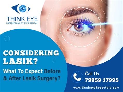 Considering Lasik What To Expect Before And After Lasik Surgery Think