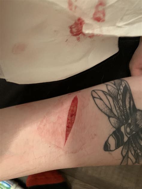 I know you can hear me i know you can feel me i can't live without you god please make me better i wish i wasn't the way i am. Teach Besides Me: Pictures Of Cuts That Need Stitches