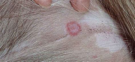 Ringworm In Dogs - What Is It And How Is It Treated?
