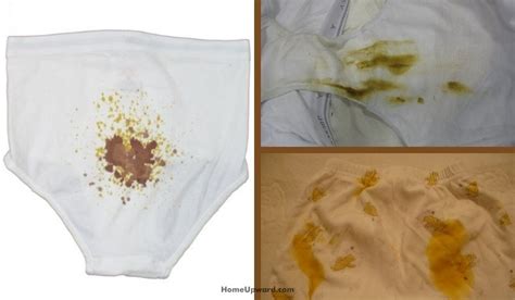 How To Remove Feces Stains From Underwear