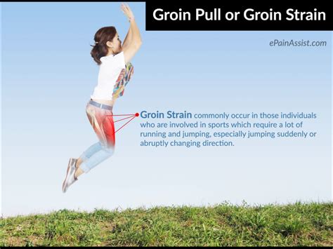 Groin Strain Health Life Media