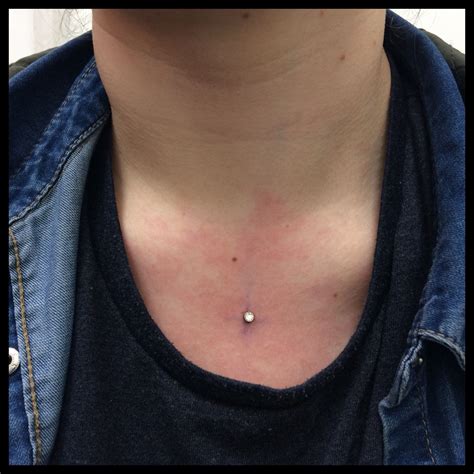 Pin On Microdermals