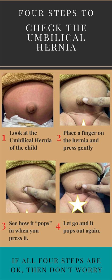 Umbilical Hernia Belt Baby Belly Button Band Infant Newborn Belly