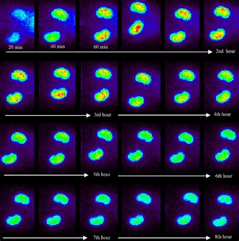 Renal Scintigraphy With 99m Tc Dmsa In Rats The Planar Images