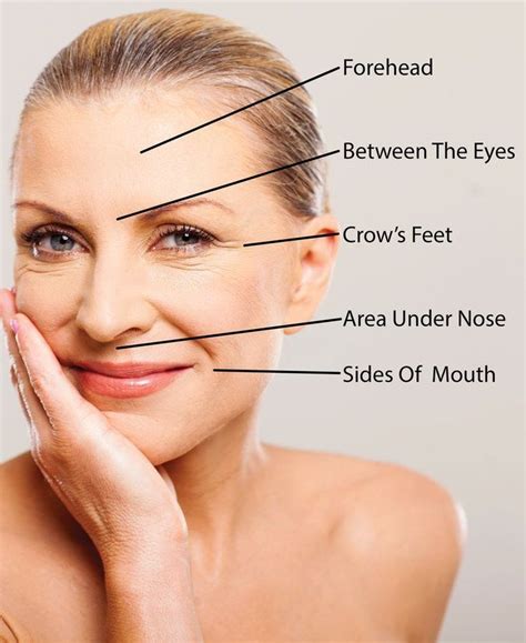 How Much Does Botox Cost Our Price Estimating Guide For Common Areas