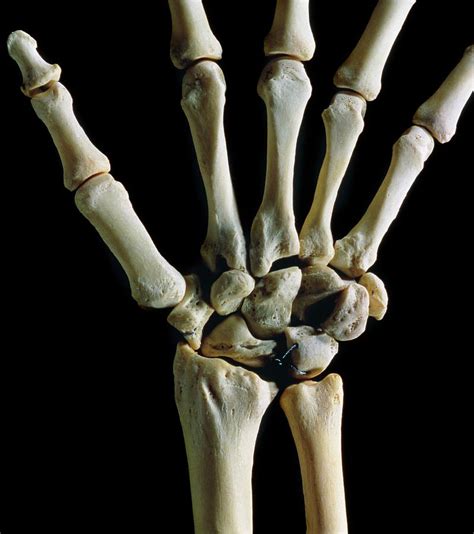 Bones Of The Wrist Joint By James Stevenson Science Photo Library