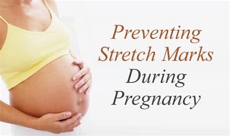 Pregnancy Stretch Marks What Can Be Done Fabmoms Prenatal And Postnatal Class For Pregnancy