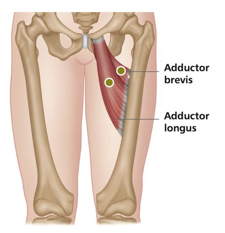 Related online courses on physioplus. Tendinitis of the Hip Adductors - Stuart Hinds Performance ...