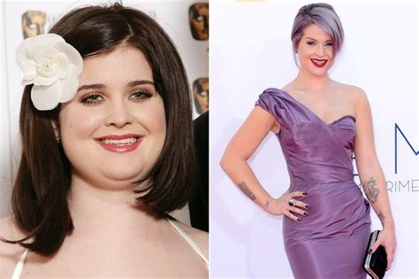 Stars Who Have Undergone A Gastric Sleeve Surgery Who Lost The Most