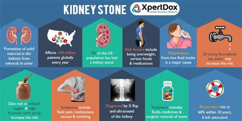 Kidney Stone Medical Terms Best Doctors Kidney Stones