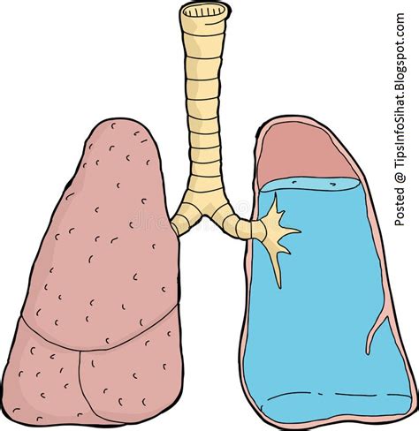 Alveoli adalah bertanggungjawab dalam proses menukar gas oksigen dan karbon dioksida yang. TipsInfoSihat - Maklumat Kesihatan Dan Penjagaan Diri ...