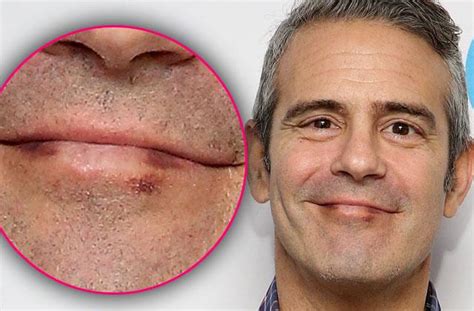 Wwhl Star Andy Cohen Goes On Air To Admit A Health Crisis