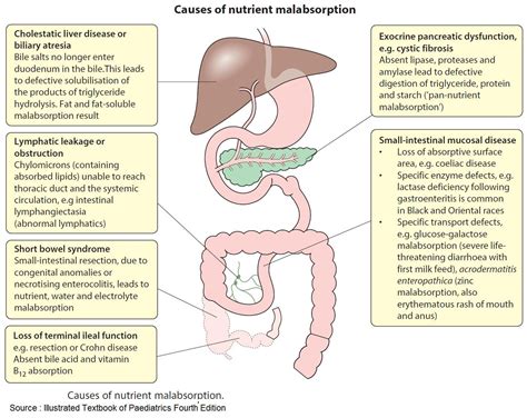 Keith Siau On Twitter Causes Of Nutrient Malabsorption Meded