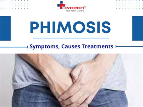 Phimosis Symptoms Causes And Treatments By Nivaran Hospital On Dribbble