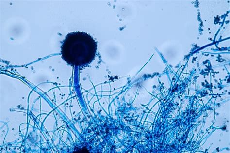 What Does Mold Look Like Under A Microscope Facts Types And Tips