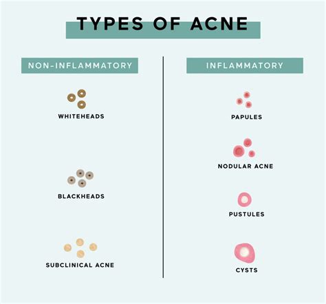 The 7 Types Of Acne Causes And How To Treat Each Pleij Salon Spa