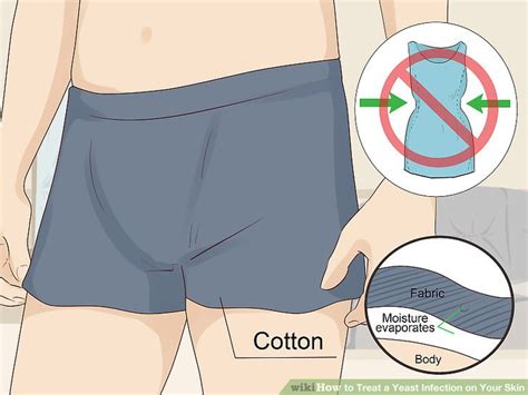 How To Treat A Yeast Infection On Your Skin 13 Steps